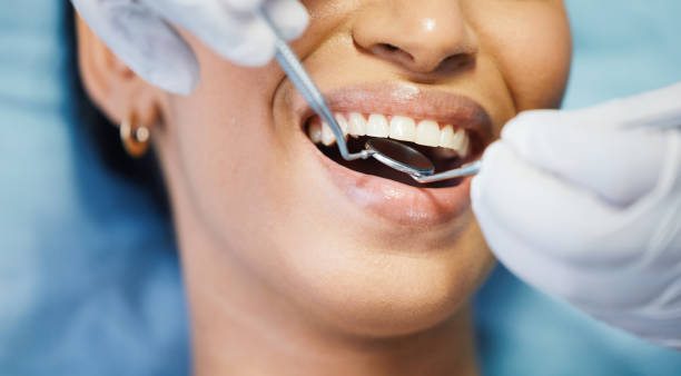 Best Dentist for Tooth Abscess  in St Cloud, MN