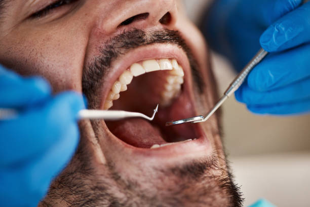 Best Emergency Tooth Extraction  in St Cloud, MN